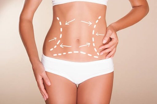 Fat Removal in Singapore: Options and Considerations